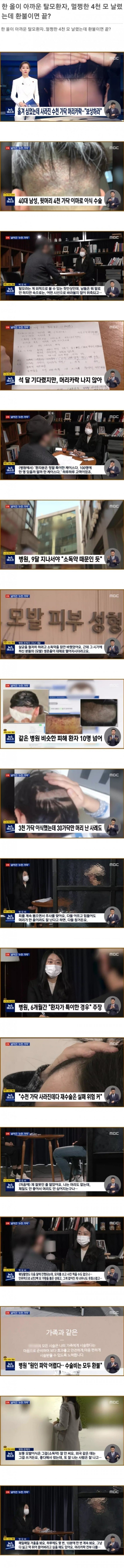 한 올이 아까운 탈모환자