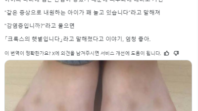 아이 발에 생긴 수상한 검은 반점이 걱정된 사람