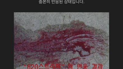 락카 스프레이 낙서를 지우는 비용이 비싼 이유